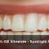 Extra 5% Off Up to 40% Off Sale – Spotlight Oral Care